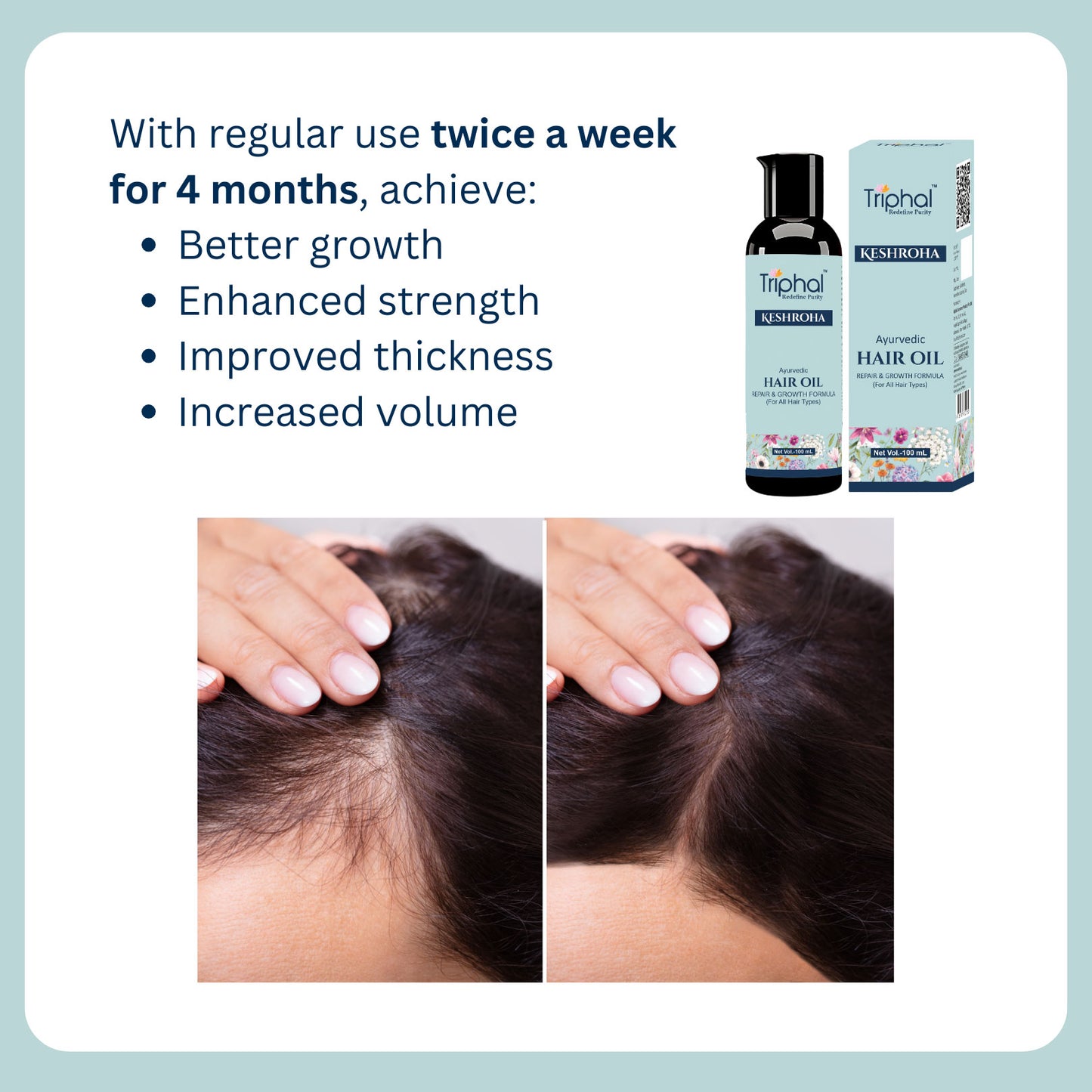 Keshroha - Ayurvedic Hair Oil - 100mL